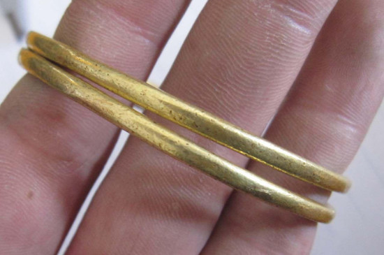 黄金手镯凹陷修复妙招